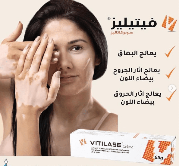 VITILASE CREAM 65G