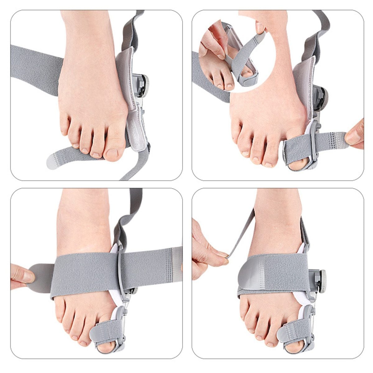 FEETIFIX BUNION CORRECTOR 1PCS